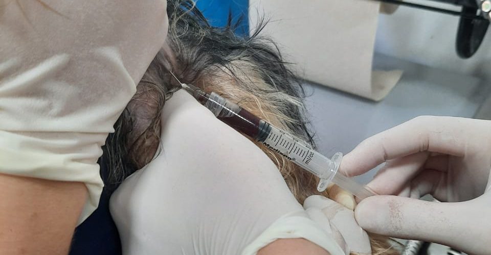 Toma-de-muestra-lactato